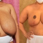 brenda duffy recommends huge amatuer tits pic