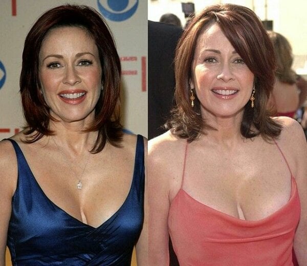 Best of Patricia heaton tits