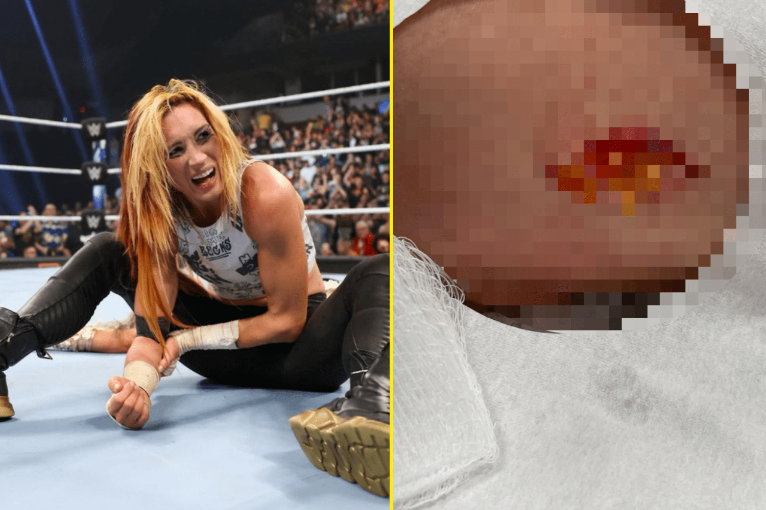 david ruf recommends becky lynch leaked pic