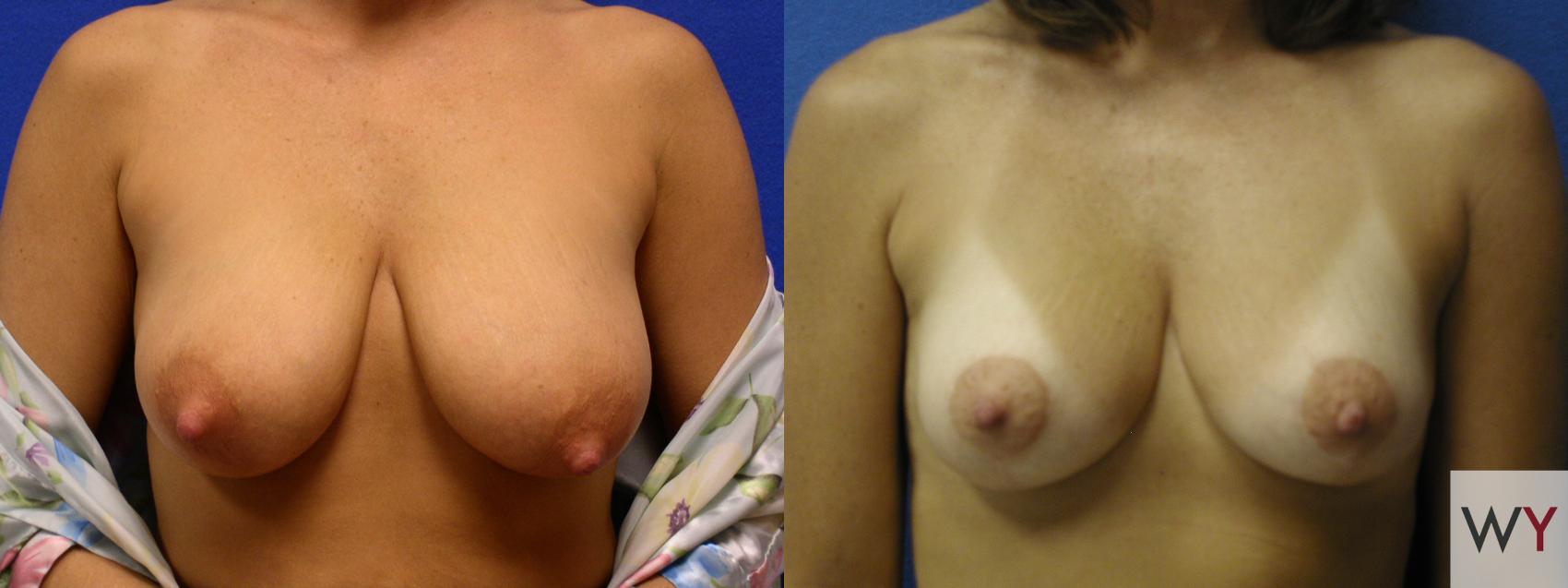 amarjit jawanda add large perky tits photo