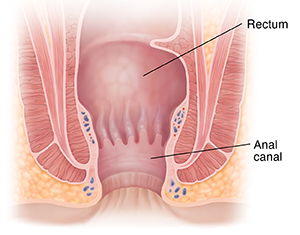 craig shumate recommends mild anal pic