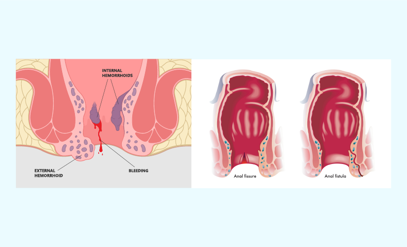 azlin abdul rahim recommends anal category pic