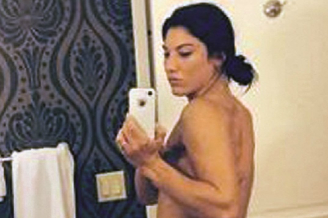 christian restrepo recommends hope solo naked pics pic