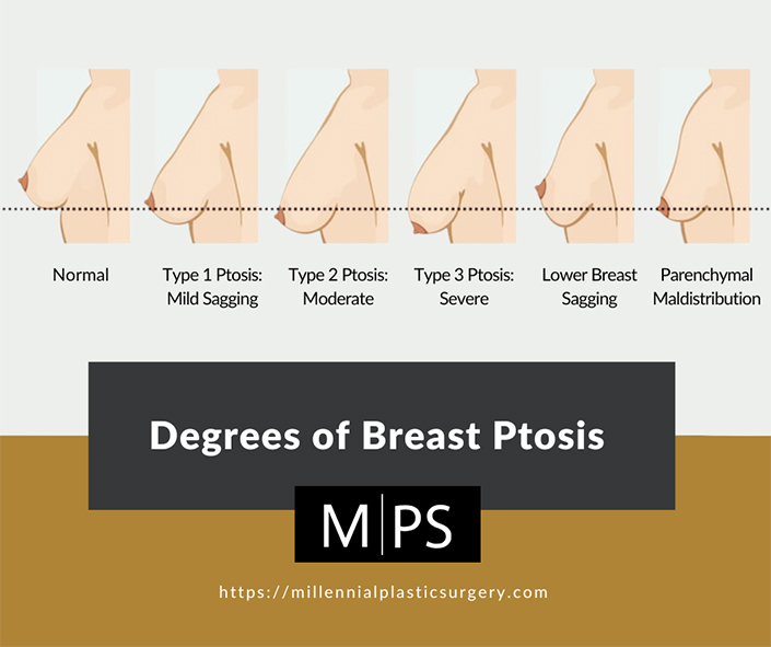 doc rob add photo perky round tits