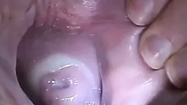 Best of Cervix stretching porn