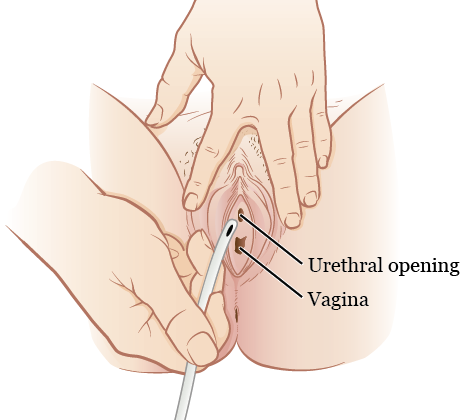 Finger In Urethra educational videos