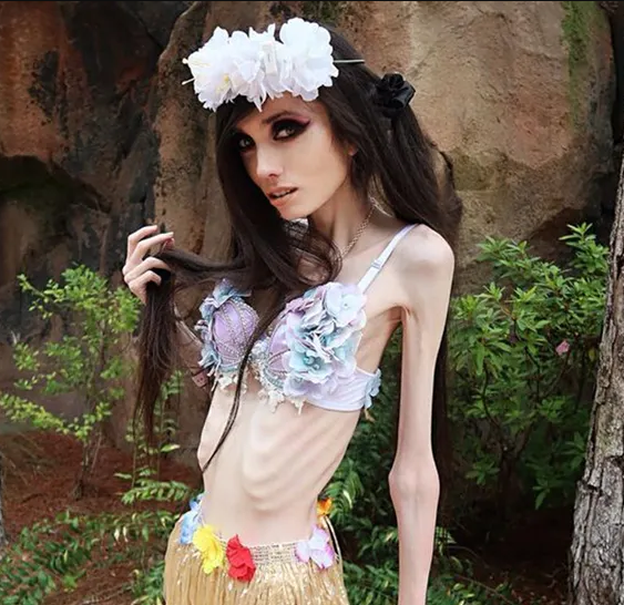 barry trapnell add photo eugenia cooney bikini