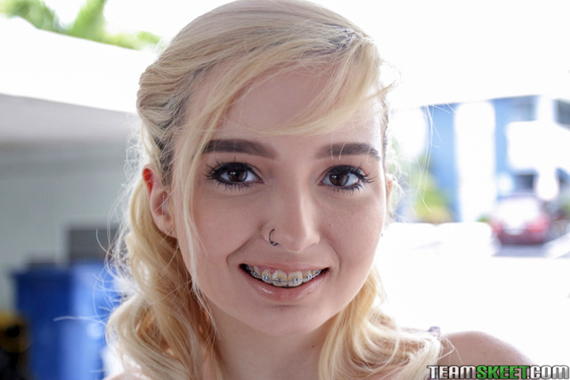 david delude share brace face porn photos