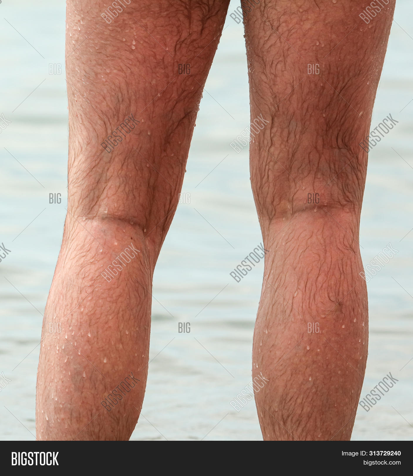 hairy male legs pics