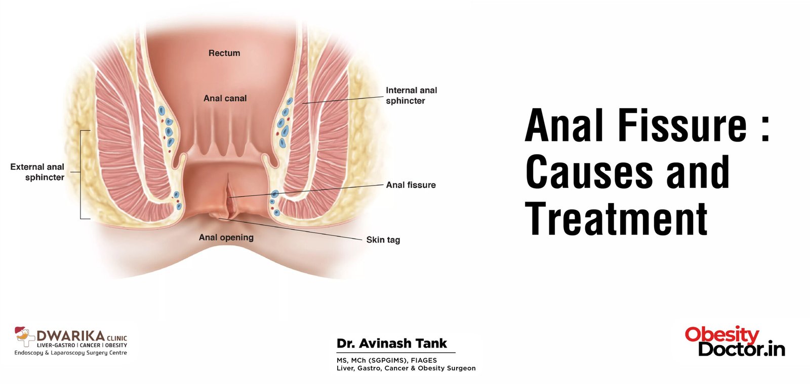 anal appetite