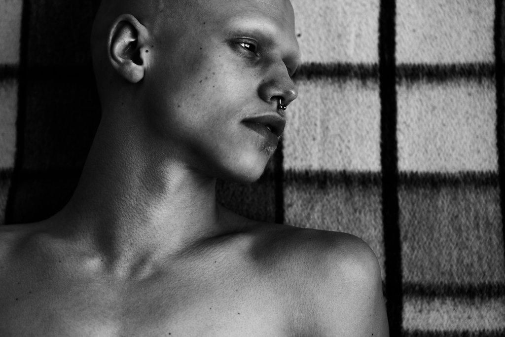 andrea j snyder add bald twinks photo