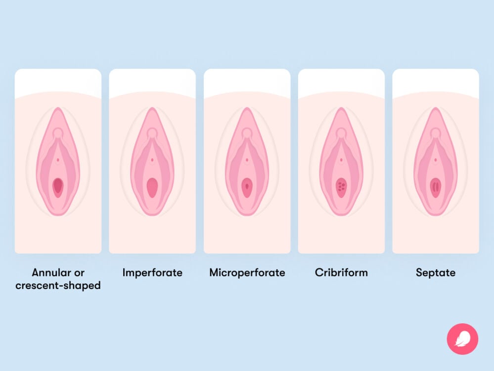 burt moore share breaking hymen with finger photos