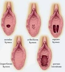 carrie jarrett recommends Breaking Hymen With Finger