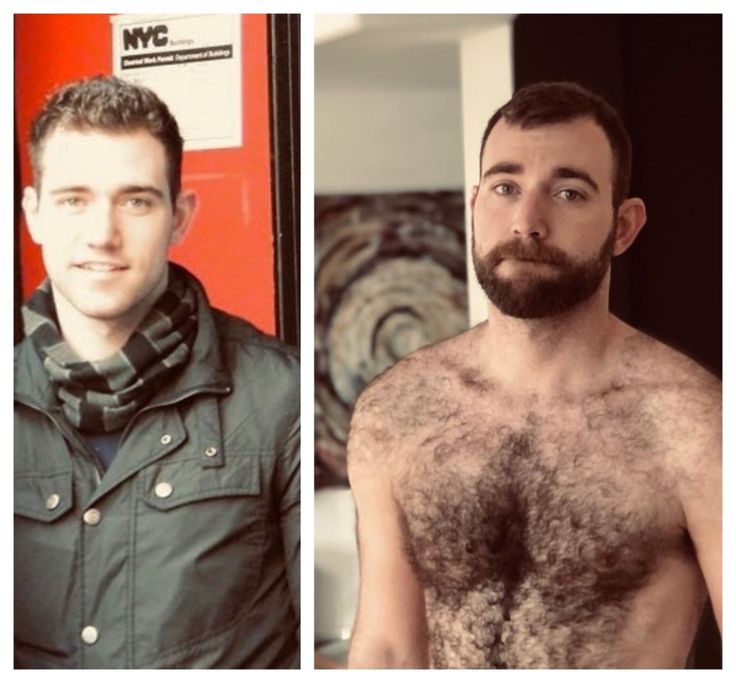 colleen cain recommends hairy twinks pics pic