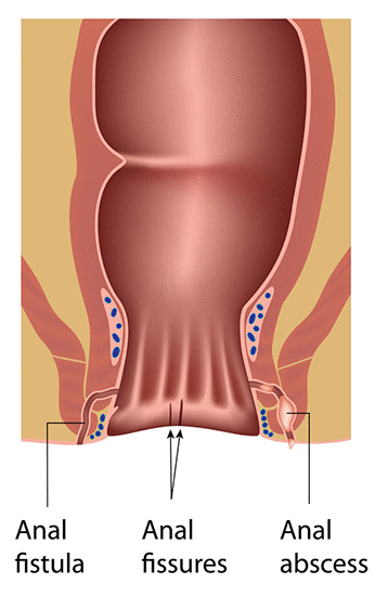 andy farnworth recommends first anal hurts pic