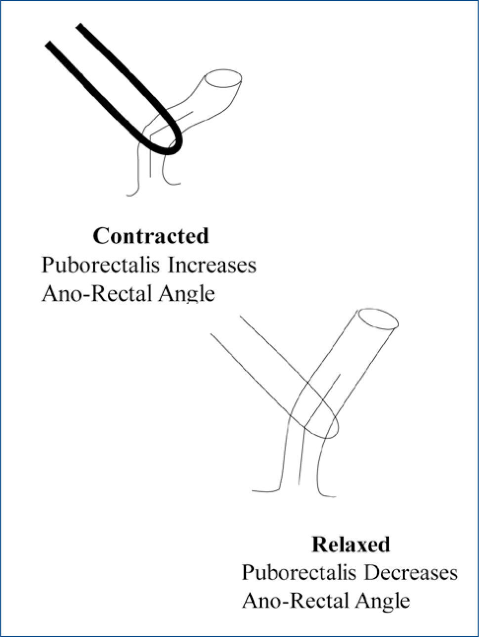 Forced Anal Training launch porn