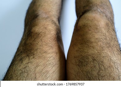 chanel odell recommends hairy male legs pics pic