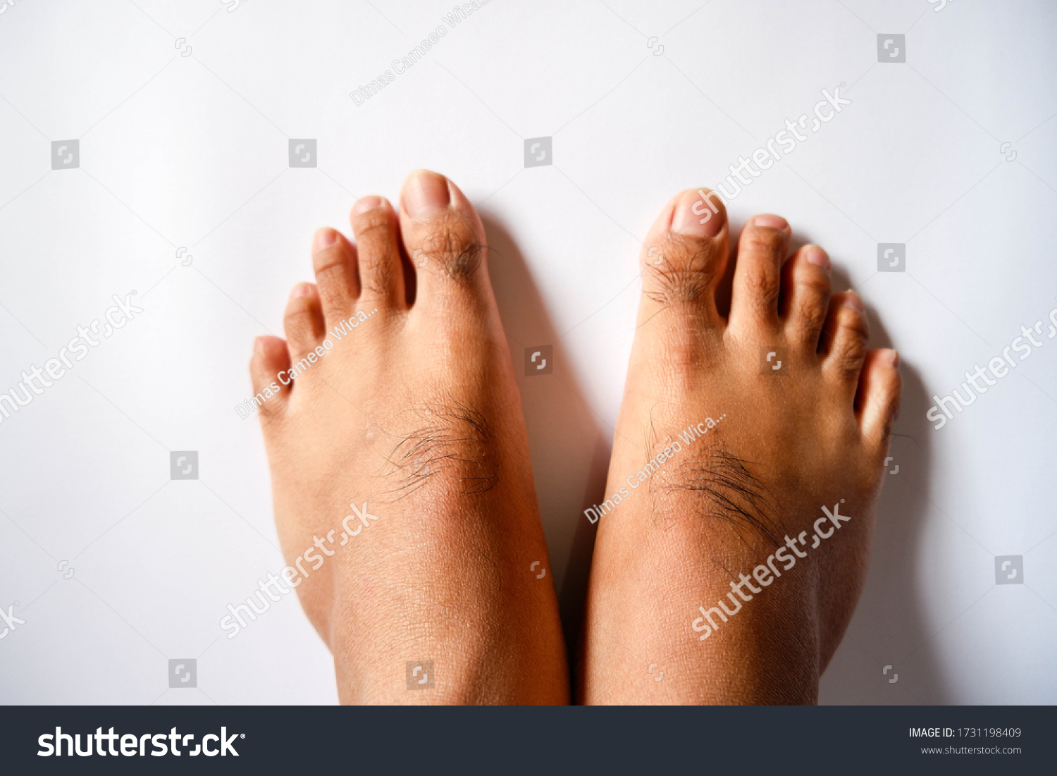 hairy men feet