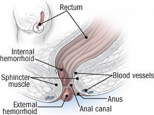 dave mechenbier recommends high def anal pic