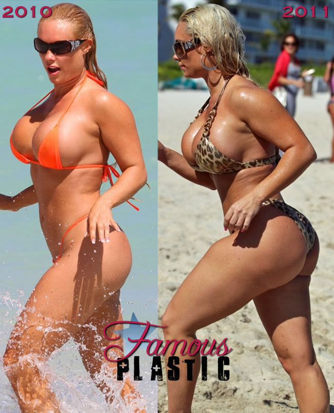 mia malkova before and after surgery