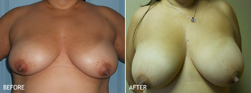 doug de vries share natural tits best photos