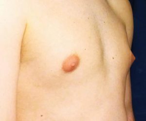 arvin sangalang recommends Puffy Breast Video