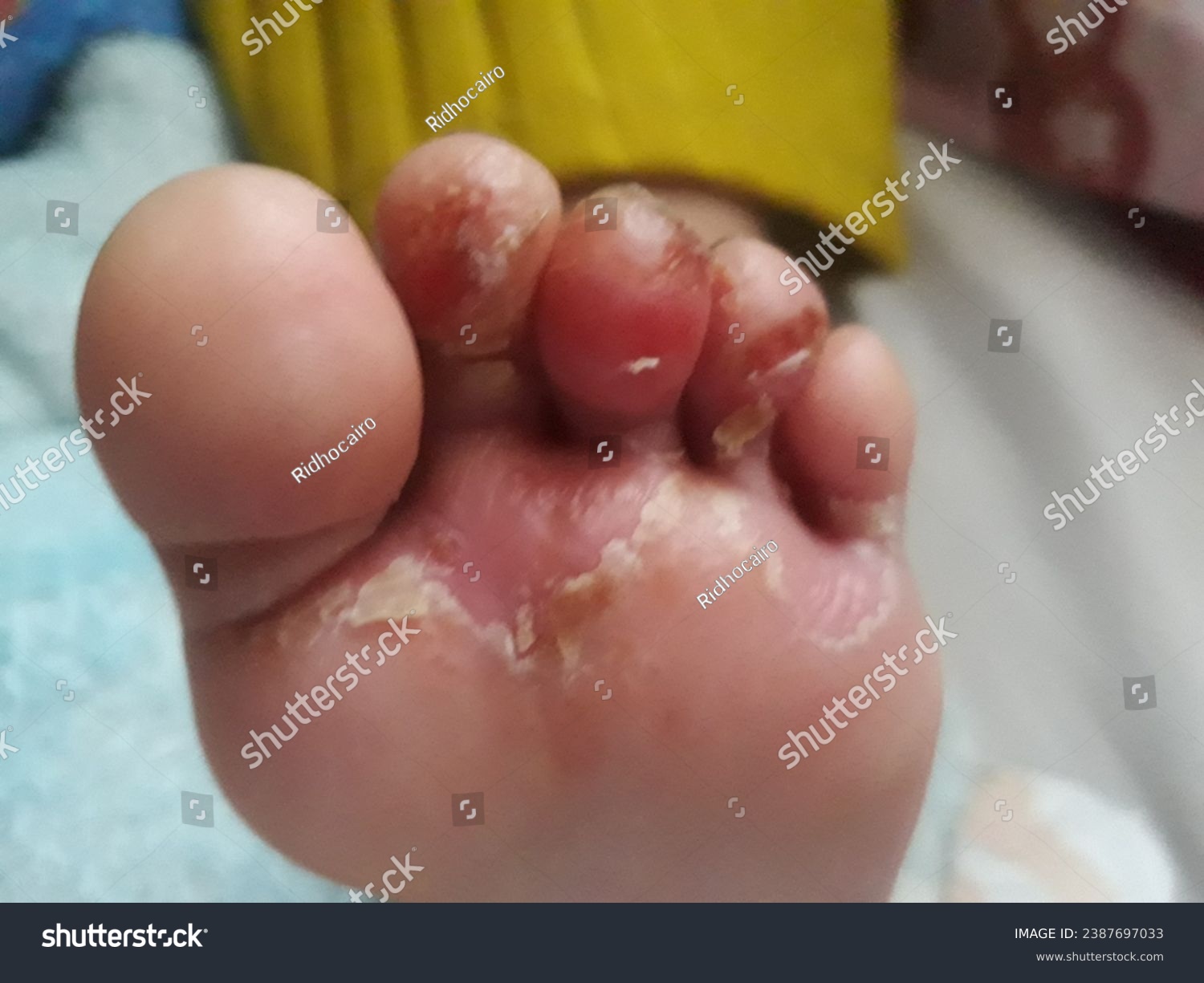 christine aguda recommends tiny feet treat pic