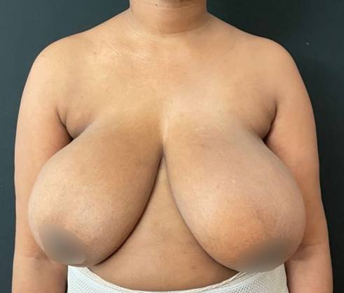 Best of Tortured breasts